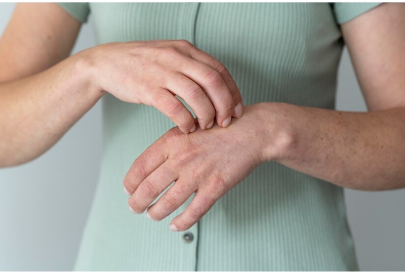 Tipos de dermatitis en las manos